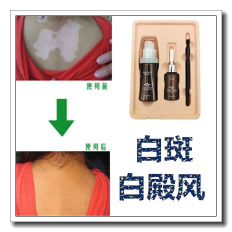 白殿风外用修护膏白斑净药膏白班修复液祛遮盖液霜剂遮瑕笔防水型