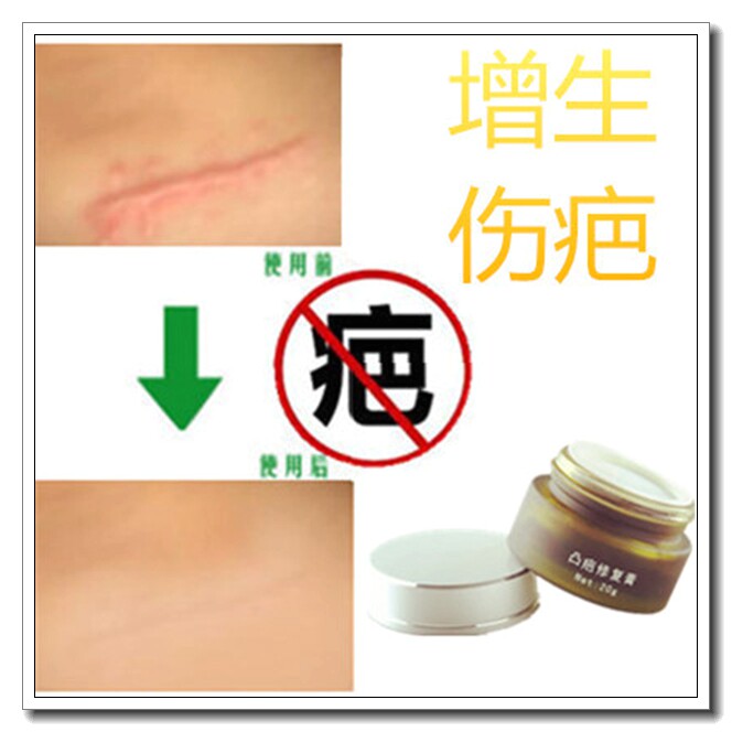 祛抓伤疤痕灵修复脸面部缝针去手术凹凸正品代谢深层黑色素的药膏