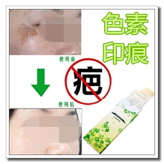 淡化脸部黑印面霜修护膏去除男女抓伤色素印痕抑制黑色素沉着回流