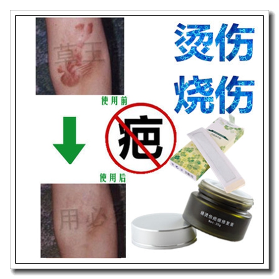 祛颈部增生疤痕软化针修复烧伤烫伤药膏正品凝胶去肉粒疙瘩黑色素