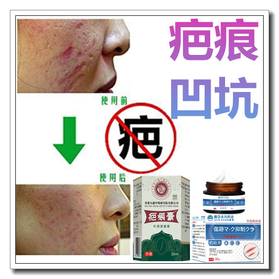 去凸疤疙瘩修复膏增生性突起手术剖腹产伤疤痕印缝针抓伤摔伤药用