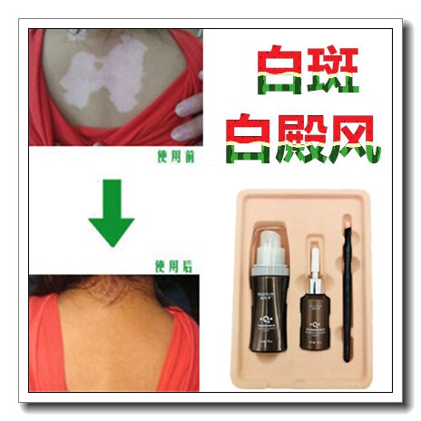 防水型白印遮瑕膏白印白疤疤痕遮盖膏白斑净肤蜡遮盖霜贴防水耐磨