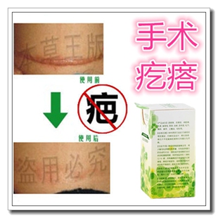 反黑修复去脸部烫烧伤疤痕药膏祛陈旧老疤膏淡化刨腹产黑色素沉淀