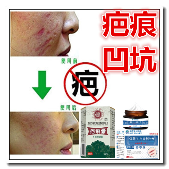草本祛红印去除色素沉淀回流增生疤痕贴凸疤疙瘩淡化黑色素印产品