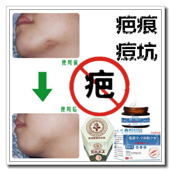 祛手术淡化增生性凸疤疙瘩产后开刀冻疮色素巴痕灵烟疤缝针液斑印