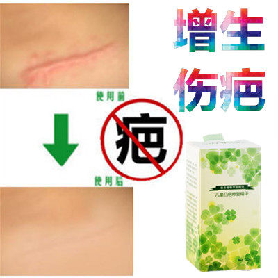 灵缝针儿童剖宫产突疤疙瘩破宫产刀伤巴痕激光手术抓伤摔伤撞伤疤