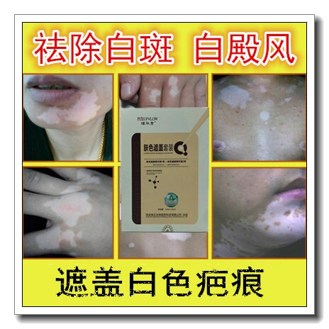 外用去白斑消褪白斑净遮盖液遮瑕膏护理液汗斑白班正品白殿风修复