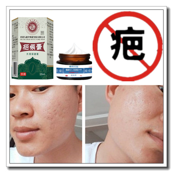 灵增生修复疙瘩性突起缝针剖宫产伤疤痕印纹身手术抓伤色素沉着疤