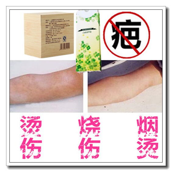 祛手术凹凸疤痕纹身贴去除抓痕红印烫伤补黑色素沉淀淡化烧伤正品