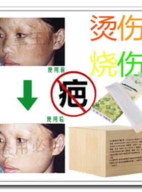 修复烫伤膏淡化烧伤黑色素印祛增生凸起软化针去创伤疤痕贴分解药