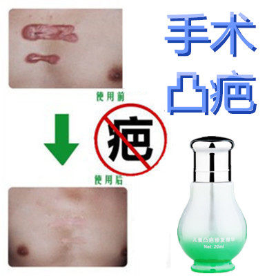 灵缝针修复剖宫产突起疙瘩破宫产刀伤巴痕烟疤手术抓伤摔伤撞伤疤