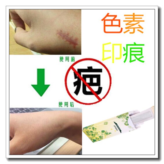 草本精华激光术后修复痘疤痕淡化暗沉红印防止黑色素沉着回流原液