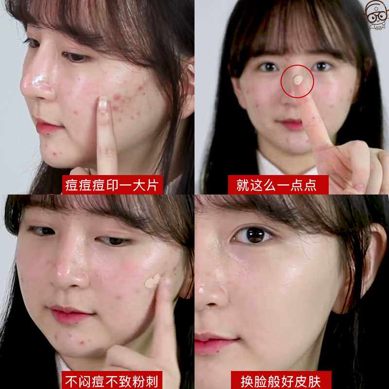 韩国medicube乐得修复遮瑕液笔膏针管神器斑点脸部痘痘黑眼圈