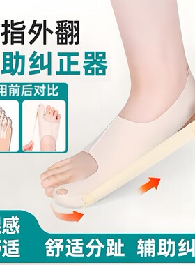 拇指外翻辅助矫正器分趾器纠正男女士大母脚趾骨突出可穿鞋脚趾套