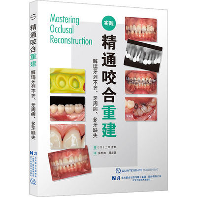 精通咬合重建 解读牙列不齐、牙周病、多牙缺失 (日)上田秀朗 著 吴松涛,周茂强 译 口腔科学生活 新华书店正版图书籍