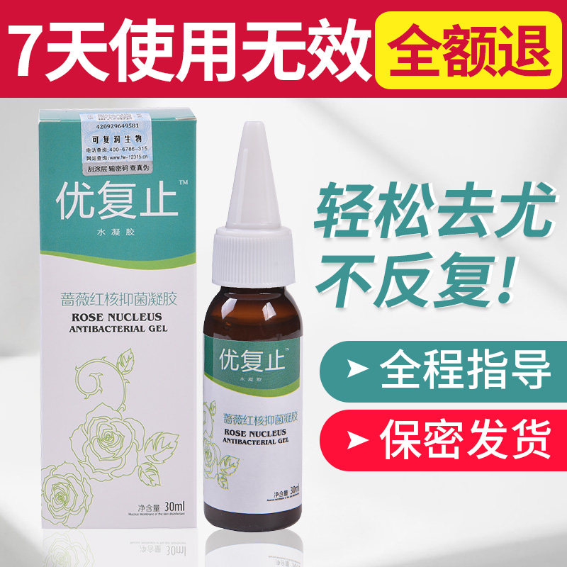 优复止尖銳濕疣男女性私处尖銳疣肛周疣丝状疣寻常疣口腔疣防復發 大慈旗舰店
