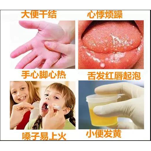 宝宝清热泡澡药包小儿童内热上火金银花泡脚包婴幼儿沐浴泡足浴包