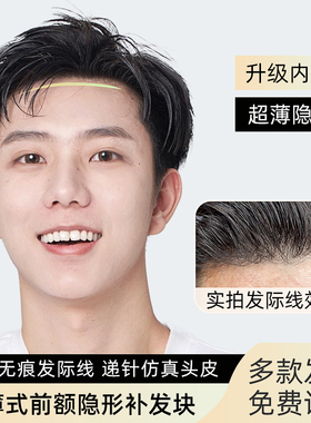 男士假发补发男全递针真发隐形无痕头顶假发片秃顶前额发际线发片