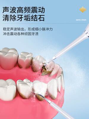 超洗牙器声波高频家用牙结石去除清洁牙齿污垢除牙石洁牙冲牙神器