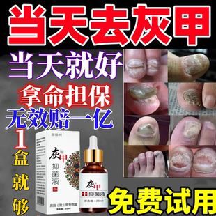 灰指甲特效亮甲药水治疗手指甲脚趾甲凤仙花专用脱甲抑菌液一滴净