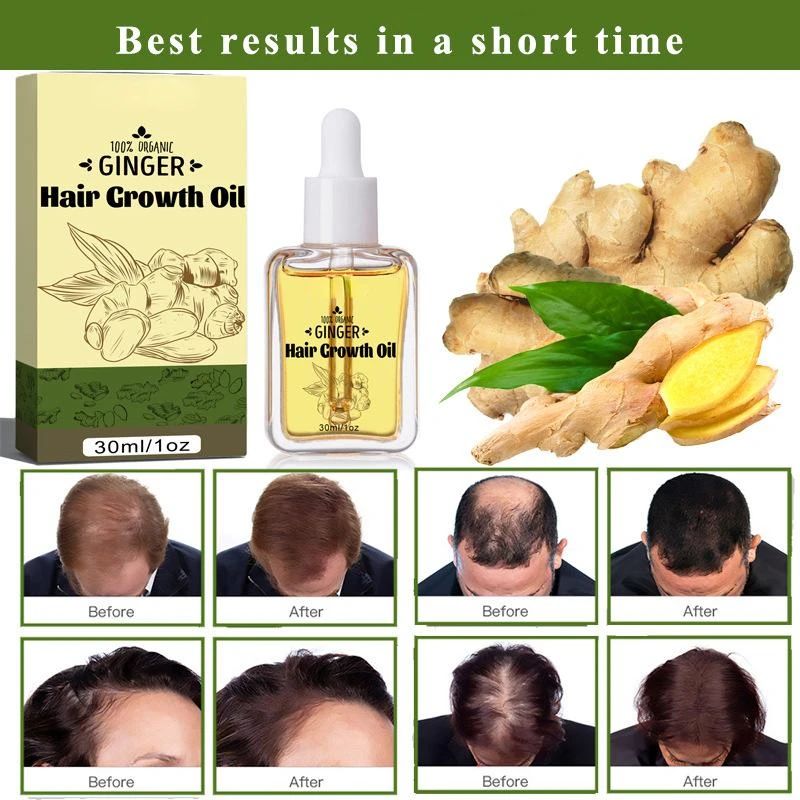 Ginger Hair Care Essential Oil 30ml Fast Hair Growth