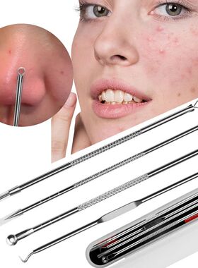 Pimples Blackhead Remover Clip Ultra-fine Tweezers Black