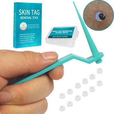 Micro skin tag remover Rubber bands for micro Skin tag wart