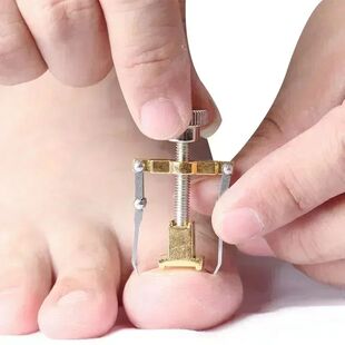Ingrown Toenail Corrector Straightening Clip Pedicure Foot
