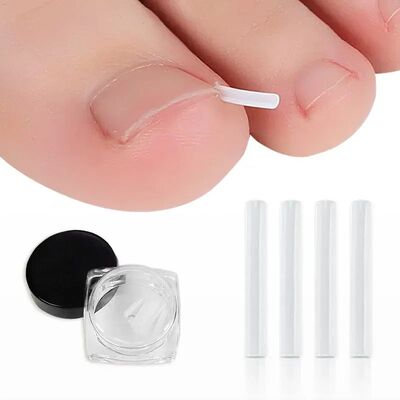 10/20/50Pcs Ingrown Nail Pad Groove Ortho Toenail Corrector
