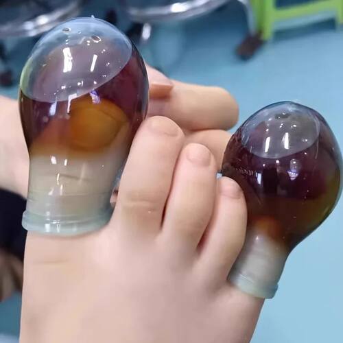 1Pcs Soft Silicone Toe Sleeves Toe Protectors, Reduce
