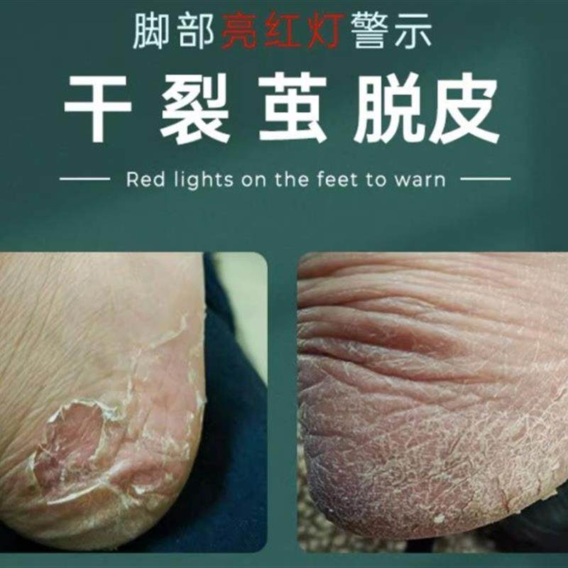 黄金愈合灵抗裂 皲裂粗糙深层渗透修复滋润买2送1买3送2买5送3,保健用品,皮肤消毒护理（消）,淘宝优惠券,粉丝福利购,淘宝优惠卷