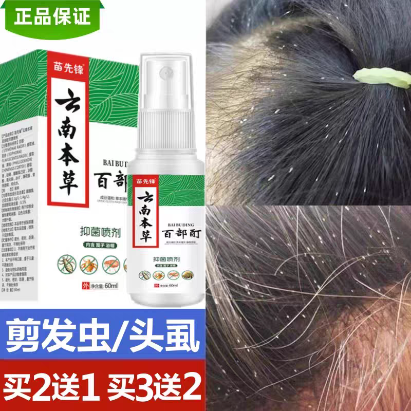 虫厮扉鲺子药虱子除剪发虫头虱女孩虱子药儿童去虱除虱药头上长虱