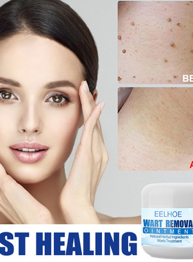 EELHOE Wart Removal Cream 皮肤去尤膏清洁克尤身体护理膏50g