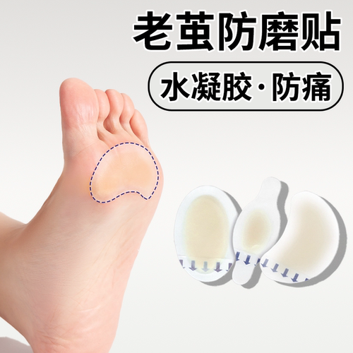 羽毛球运动预防老茧防磨脚鸡眼