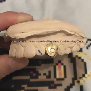 14K黄金雕刻字母金牙嘻哈潮流珠宝金牙套Au585私人定制Grillz