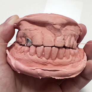 10K金牙套Grillz白金欧美嘻哈金牙hiphop单颗纯K金私人定制珠宝配