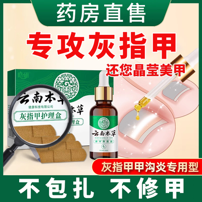 云南本草灰指甲冰醋酸专用正品