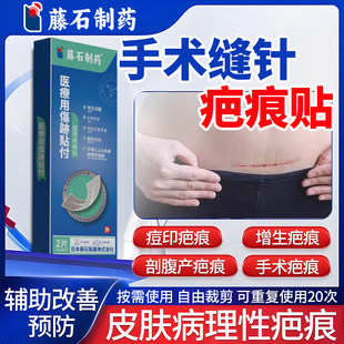 手术缝针疤痕搭修复除疤膏手术伤口刀口祛疤贴剖腹产护去搭凝胶LQ