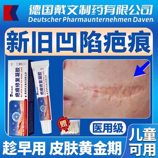 凹陷性疤痕生长因子儿童小孩脸部填充修护凹陷祛除疤膏专用凝胶LJ