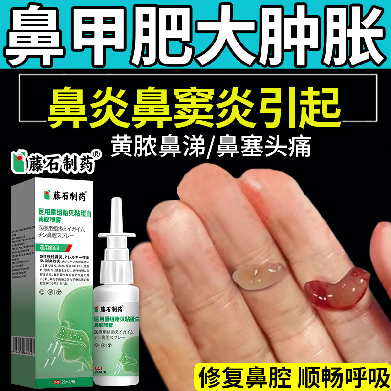 【藤石制药】鼻甲肥大肿胀图片