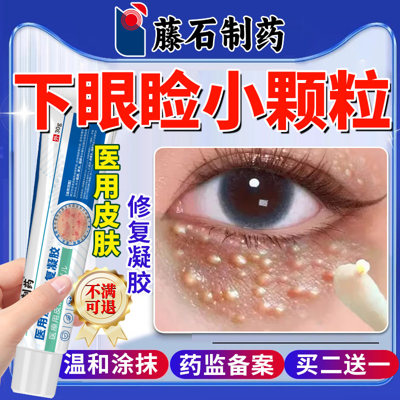 眼部小颗粒搭汗管器瘤除药房同售膏专用脂肪粒点扁平疣祛眼周HY