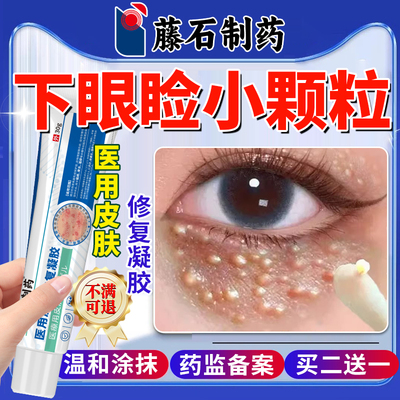 【医用同款】下眼睑汗管瘤膏