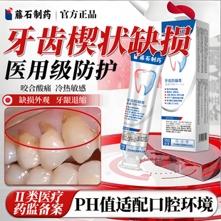 藤石制药牙齿楔状缺损搭修补膏牙龈萎缩医用敏感酸痛脱矿涂氟RD
