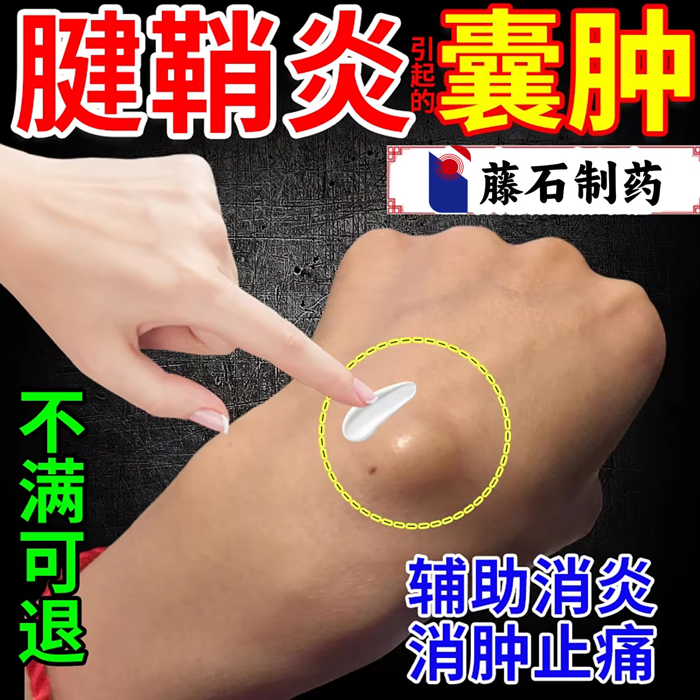腱鞘囊肿贴鼓包可搭配专用膏药贴健鞘炎痛腱鞘炎护腕手腕YU