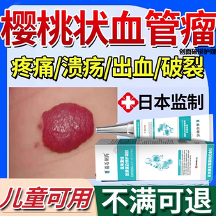 藤石制药樱桃状血管瘤血管痣去专药监备案凝胶去点痣无痕正品YU