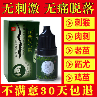 去除猴子刺猴肉跖血泡刺肉刺手部刺猴脚底去猴灵足部刺猴去除正品