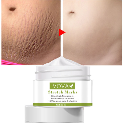 跨境VOVA Stretch Marks Cream 30ml