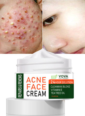 跨境现货VOVA ACNE FACE CREAM 30ml 速卖通亚马逊可授权