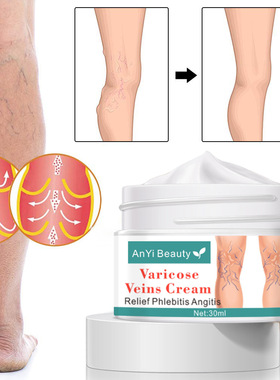 跨境AnYi Beauty varicose veins cream 30ml
