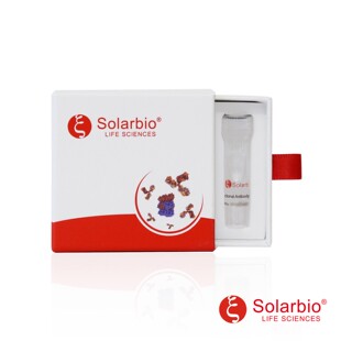一抗ActivAbTMAnti-PFKFB3 Polyclonal Antibody